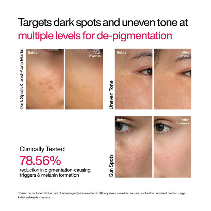 Advanced Dark Spot Correcting TXA Shot