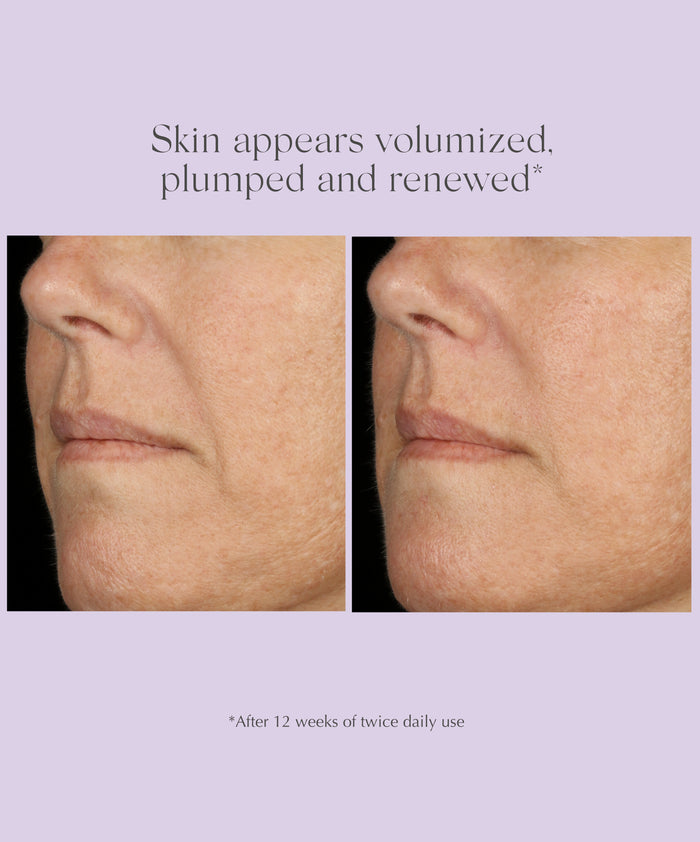 AGE REVERSE+ Total Correct Serum