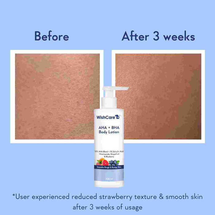 picture about how aha bha body lotion works on strawberry legs and body acne