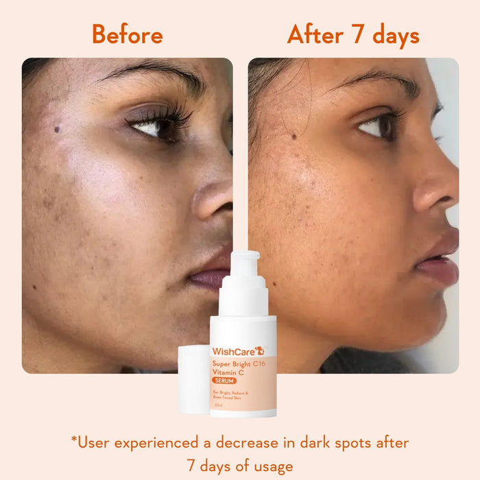 De-pigmentation Duo