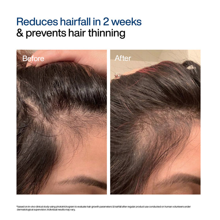 Hair Growth Serum Concentrate