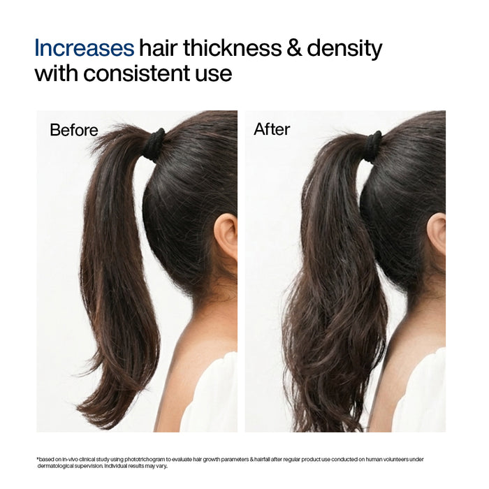 Hair Growth Serum Concentrate