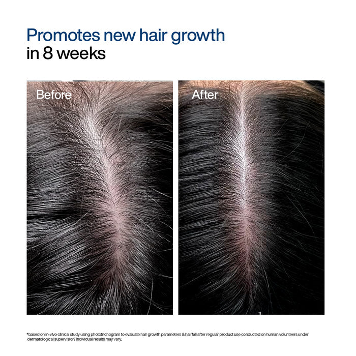 Hair Growth Serum Concentrate